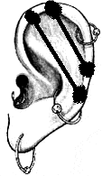  (113x195, 6Kb)