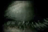  (100x67, 46Kb)