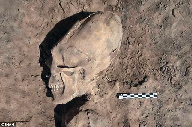 Зачем древние люди меняли себе форму черепа?
