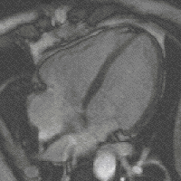  (200x200, 182Kb)