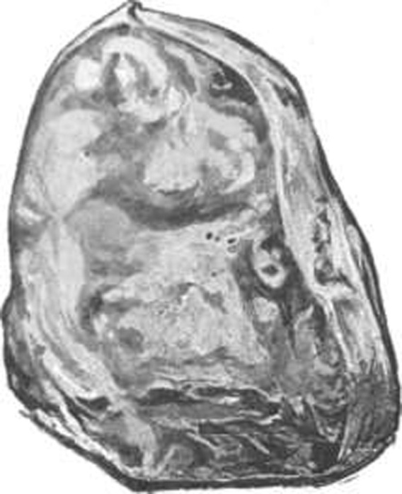 Diamant_Excelsior1899 (568x698, 81 Kb)