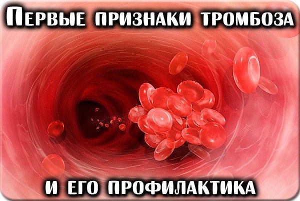 5567416_FVxpzZ9LQjw (600x403, 60Kb)