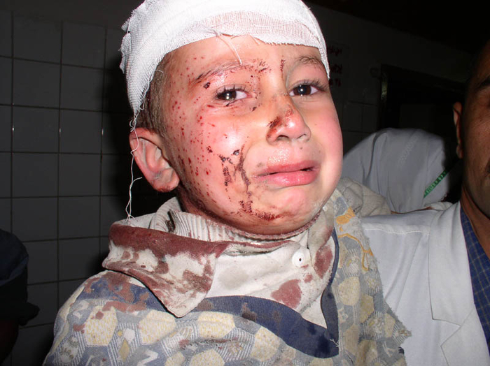 muhammed_adman.__received_cuts_to_his_head_and_face_from_shr (700x524, 329Kb)