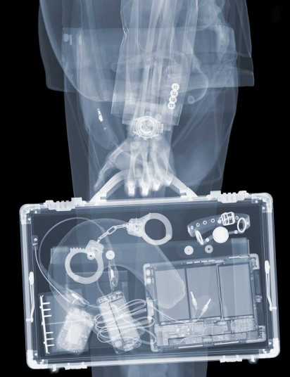 Необычные рентгеновские образы