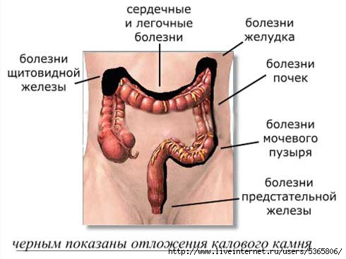 5365806_Ochischeniekishechnika (490x367, 70Kb)