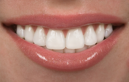 Как сделать зубы белыми, если отбеливание противопоказано (2) (448x285, 126Kb)