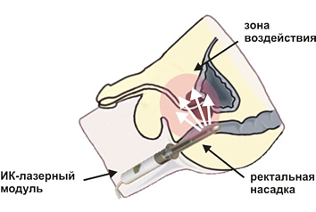 3407372_panfundus_ru_trima__10_intradont (354x238, 22Kb)