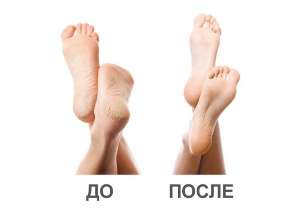 5850658_anywalls_com73563 (600x433, 21Kb)