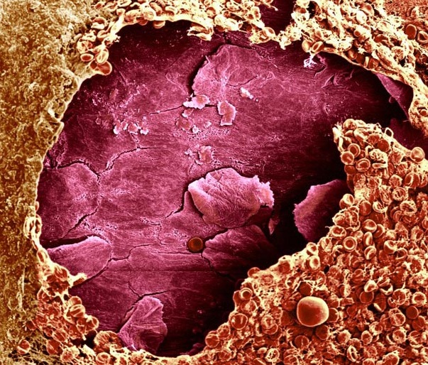 looking-at-the-world-through-a-microscope-wound (603x514, 205Kb)