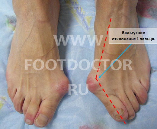 61985484_foot_001 (520x427, 62Kb)