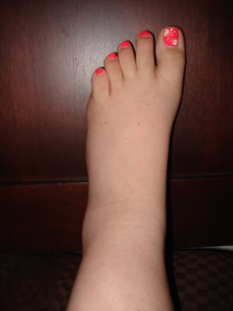 swollen-foot-pregnancy (480x640, 112Kb)