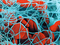 1327526846_fibrin1 (200x150, 24Kb)