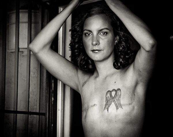Коллекция шокирующих фотографий жертв рака молочной железы после операции