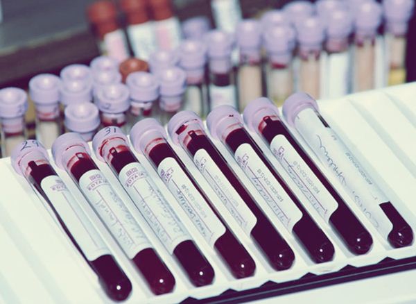 Простой анализ крови находит рак на самой ранней стадии