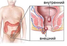 торговля диетическими продуктами