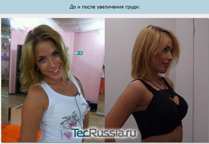 увеличение груди в самаре цены увеличение груди в самаре цены