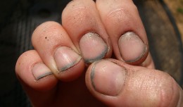 dirty-nails-260x152 (260x152, 9Kb)