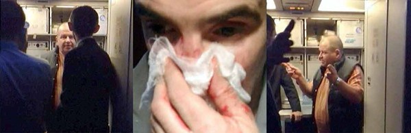 Пассажир самолета «Москва-Хургада» сломал нос соседу, избил проводника