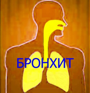 bronhit-lechenie-v-domashnih-usloviyah-291x300 (291x300, 20Kb)