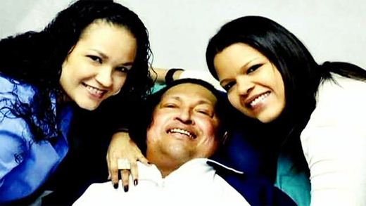 Фотографии Уго Чавеса после удаления раковой опухоли