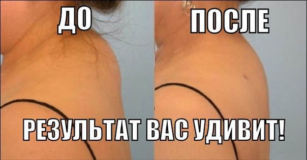 1 (604x316, 36Kb)