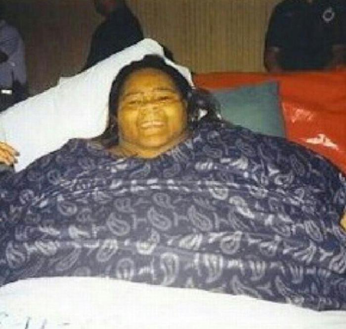 Ужасный вид полутонной женщины, которая похудела на 230 килограмм!
