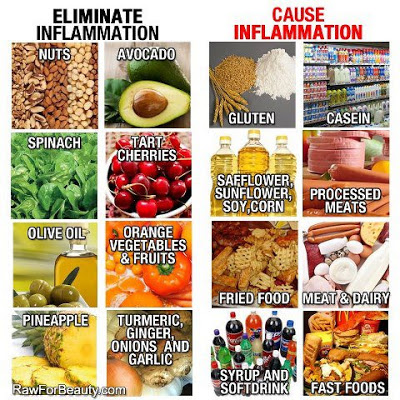 naturally-reduce-inflammation (400x400, 108Kb)