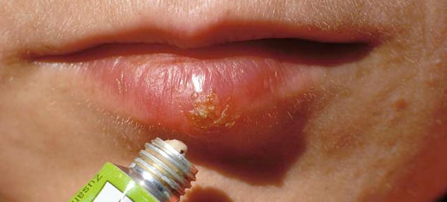 sites rencontres herpes