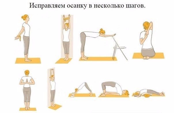 Фиксированный сколиоз грудного отдела