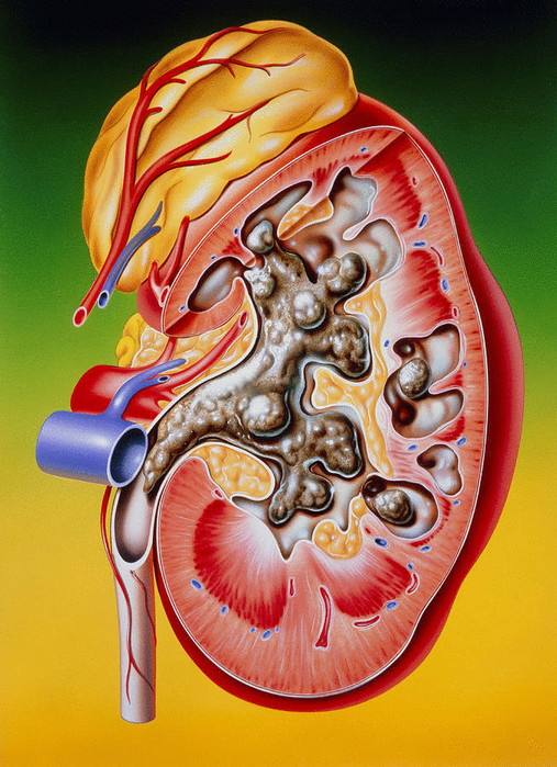 3085196_content_kidney_art (507x700, 164Kb)