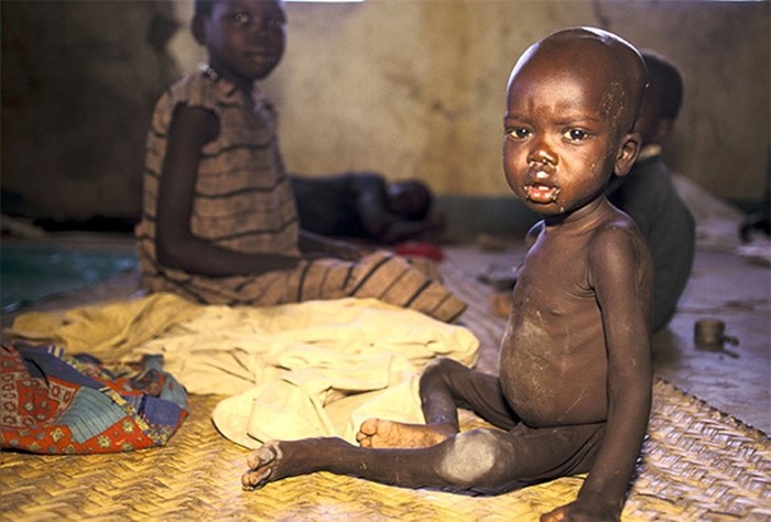 Как в Африке совершают ритуальные убийства детей и альбиносов