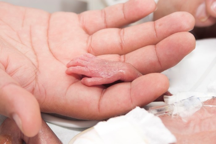 10 фактов о детях, родившихся преждевременно