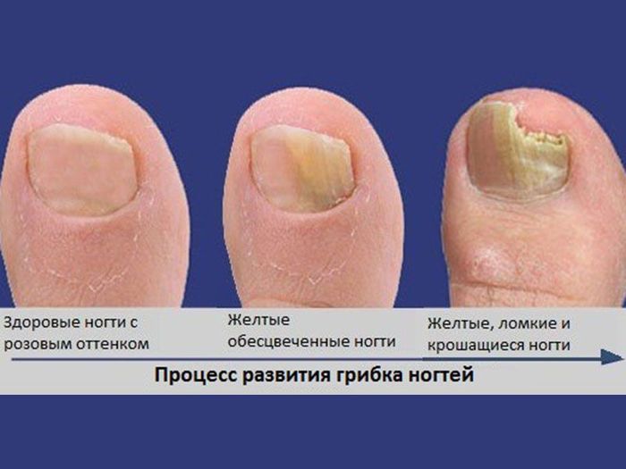 У меня гребок ногтей У меня гребок ногтей