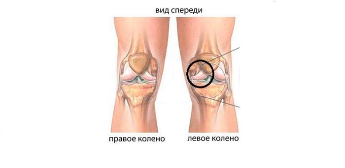 Дмитрий Невский. Модная ведьма.Таро ведьм (стр. 1) Дизайн маленькой кухни в Хрущевке: 100 фото идей