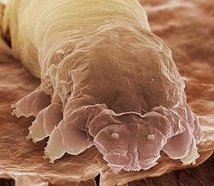 3925311_demodex_brevis (214x186, 12Kb)