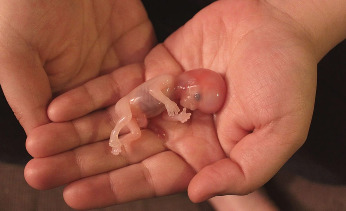 Как женщины делают аборты своими руками, чтобы избавиться от нежеланного ребенка