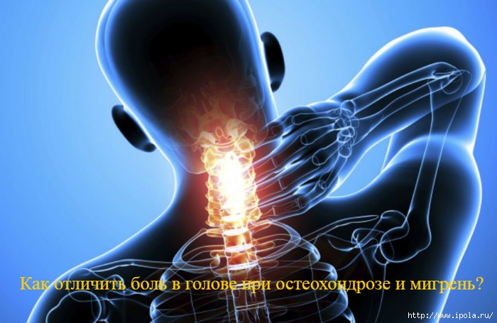 alt="Как отличить боль в голове при остеохондрозе и мигрень?"/2835299_OSTEOHONDROZ_1_ (700x455, 217Kb)