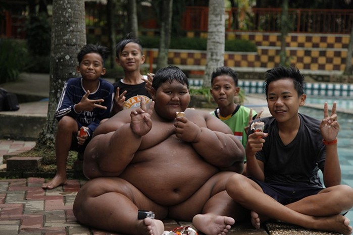 Самый толстый мальчик в мире решился на похудение и сбросил 83 килограмма