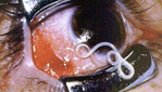 Превью Worms-eyes (500x285, 99Kb)