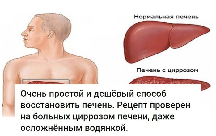 Как быстро снять боль в печени в домашних условиях Как быстро снять боль в печени в домашних условиях