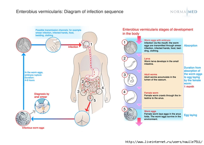 4869548_csm_schema_enterobius_vermicularis_infectionsequences_416314aa98 (700x497, 170Kb)