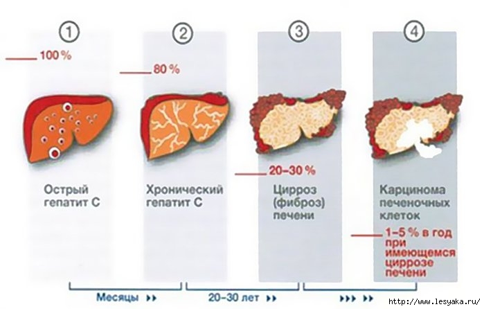 3925073_19750379gepatitv2 (700x446, 103Kb)