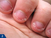 Как отучить детей грызть ногти? Способы и средства