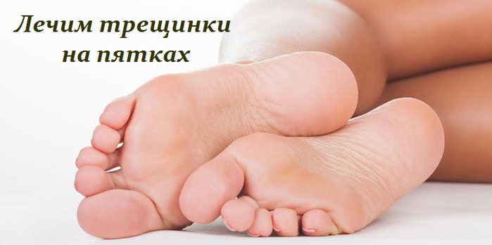 2749438_Lechim_treshinki_na_pyatkah (700x349, 226Kb)