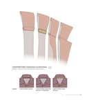  The_Shirtmaking_Workbook_Pattern_Design_and_Construction_Resources_-_More_than_100_Pattern_Downloads_for_Collars_Cuffs-047 (605x700, 95Kb)