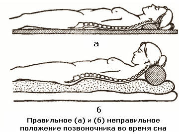 5537954_pravilnoepolozheniegolovypoGogulan (374x269, 21Kb)