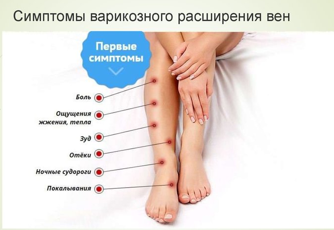 alt="Как бороться с варикозным расширением вен при помощи упражнений?"/2835299_varikoz (678x468, 291Kb)