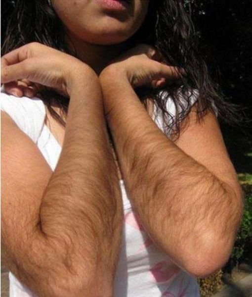 1321267252_1320754699_hairy_arm_10 (510x600, 48Kb)