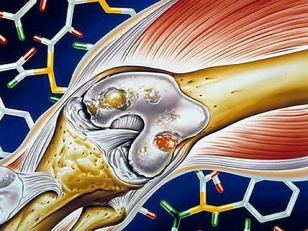 2835299_Prostoi_recept_narodnoi_medicini_dlya_ochisheniya_systavov1 (600x450, 61Kb)