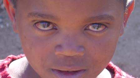 http://img0.liveinternet.ru/images/attach/b/0/10846/10846360_Dagoretti_kid_red_eyes.JPG